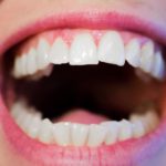 Zdrowe zęby – sposób na piękny uśmiech